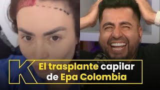 Epa Colombia cuenta que nunca recibió algo de la selección Colombia [upl. by Chemaram817]