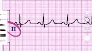 ECG  Derivaciones y caras  1 Ciclo cardiaco básico [upl. by Erkan]