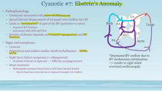 Congenital Heart Disease Video 9 [upl. by Nikki]