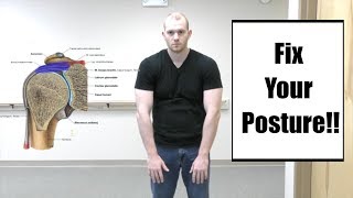 Shoulder Impingement Syndrome  Exercises for Shoulder Pain [upl. by Kippie]