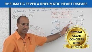 Pathogenesis of Rheumatic Fever  Rheumatic Heart Disease 🧑🏻‍⚕️ [upl. by Aonehc]