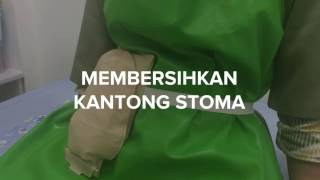 Membersihkan kantong kolostomi [upl. by Micheil]