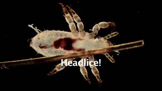 Head Lice Microscopic View [upl. by Elleuqram]