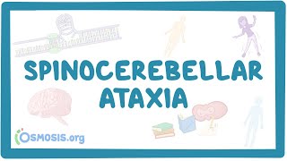 Spinocerebellar ataxia  causes symptoms diagnosis treatment pathology [upl. by Luebke]