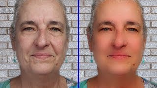 65 Year Old Tries Instant Wrinkle Cream for her Under Eye Bags [upl. by Lleynod651]