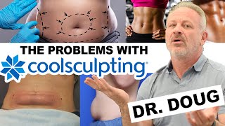 The True Cost of COOLSCULPTING 😱 Body Modification DISASTERS [upl. by Suirtimed835]