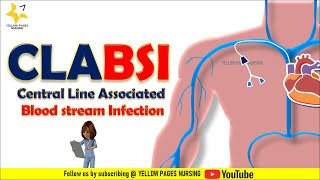 CLABSI  Central line related bloodstream infection  CLABSI Bundle  Types of CVCs [upl. by Soluk]