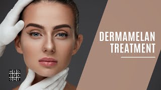 Dermamelan Treatment [upl. by Adnohsad]