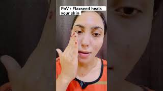 Flaxseed heals up explore viralvideo trending skincare shorts ytshorts yt NephroZainab [upl. by Ytsud]