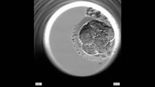 Blastocyst seen with EmbryoScope [upl. by Nemajneb]