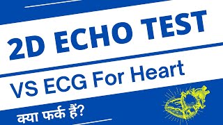 2D Echo or ECG Test for Heart Test  Heart Tests Explained in Hindi [upl. by Lenoyl]