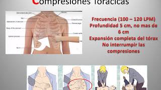 9° Modulo  C Actualización y evidencia en el paro cardiorespiratorio [upl. by Aicela]