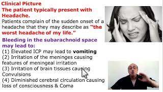 Subarachnoid Hemorrhage [upl. by Anneyehc307]