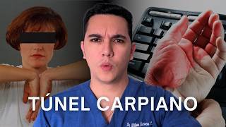 ¿Manos entumecidas Podrías tener túnel carpiano  Dr William Guerrero [upl. by Bala919]