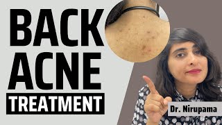 Back Acne Pimples on back Back acne treatment Back acne spots How to get rid of back acne2022 [upl. by Aicelf]