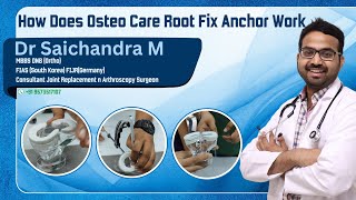 How Does Osteo Care Root Fix Anchor WorkDr Sai Chandra MBBS DNB Ortho Hyderabad [upl. by Anwahsit]