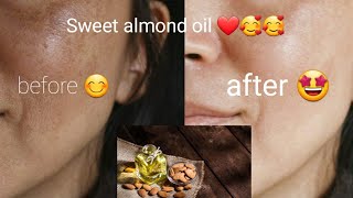 Almond Oil for Skin Hair and Face  5 Benefits of Sweet Almond Oil [upl. by Zeuqcaj358]