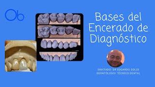 Morfología Dental y Encerado de Diagnóstico [upl. by Aketal]