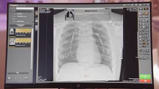 CARESTREAM Image Suite Software with DRXDetector Xray Imaging [upl. by Lal]