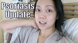 Psoriasis Update  February 19 2016  ItsJudysLife Vlogs [upl. by Woodman492]