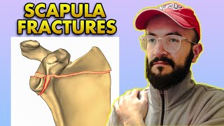 Scapula Bone Fractures Anatomy Classification Clinical Features and Treatment [upl. by Rizzo]