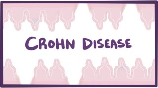 Crohns disease Crohn disease  causes symptoms amp pathology [upl. by Utimer185]