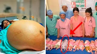 Mother Gives Birth to 10 Babies and Doctors Realize One of Them Isnt a Baby Biggest Shock [upl. by Mutua679]