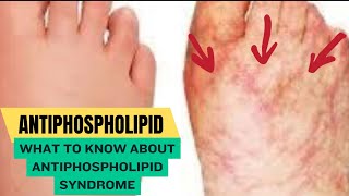 Antiphospholipid Syndrome [upl. by Kay494]