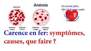 Carence en fer 🥦🥬🥒🥩 symptômes causes que faire [upl. by Nussbaum]