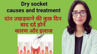 Dry socket after tooth extraction causes and treatmentदांत उखड़वाने के कुछ दिन बाद दर्द होना [upl. by Arek]