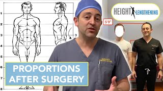 Will My Body Be Proportional After Limb Lengthening Surgery  Height Lengthening FAQs [upl. by Nhar]