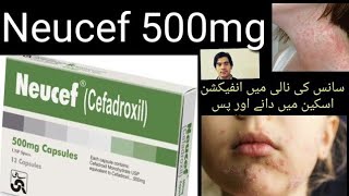 neucef 500mg capsule Cefadroxil Antibiotic Cephalosporin group ll جلد کی بیماریوں کا علاج Dentalpain [upl. by Solberg369]