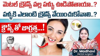 Which Crowns best for Your Teeth  Types of Dental Crowns  Root Canal Treatment Tips in Telugu [upl. by Asoramla616]