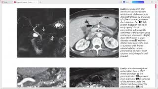 PANCREAS DIAGNOSTIC IMAGING SERIES [upl. by Acisej]