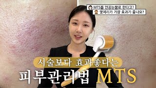 요즘 핫한 셀프MTS 부작용은 없는데 효과 배로 보는법 [upl. by Brownson157]