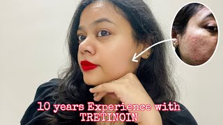 My 10 YEARS TRETINOIN CREAM Journey quotट्रेटिनॉइन क्रीम के लाभ और सावधानियांquot [upl. by Micco]