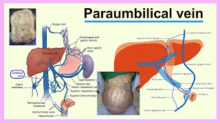 paraumbilical vein [upl. by Kyl]