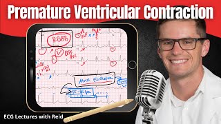 Premature Ventricular Contractions PVC EKG  ECG Lecture [upl. by Mortimer]