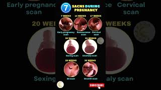 Types Of Scans During Pregnancy baby scanning scan pregnancy shortsvideo ytshorts [upl. by Mok]