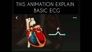 ECG Made Simple Understanding Heart Rhythms [upl. by Ecylla]