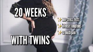 20 WEEK TWIN PREGNANCY UPDATE  IM IN SO MUCH PAIN [upl. by Luht]