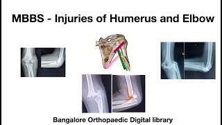 MBBS  Humerus and Elbow injuries [upl. by Ayikan953]