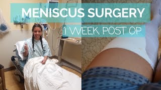 Meniscus Surgery Recovery Vlog partial meniscectomy Week 1 Post Op [upl. by Lekkim273]