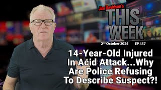 Jim Davidson  14YearOld Injured In Acid AttackWhy Are Police Refusing To Describe Suspect [upl. by Queena]