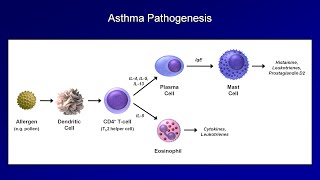 Asthma and COPD  Pathogenesis and Pathophysiology [upl. by Ladnyc]