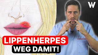 Lippenherpes Wieso kommt Herpes immer wieder Behandlung amp Vorbeugung von Herpesbläschen  Ursachen [upl. by Tildy346]