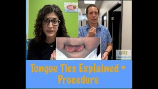 All Tied Up Understanding Tongue Tie and the Procedure Experience  Lets Talk About [upl. by Nancy]