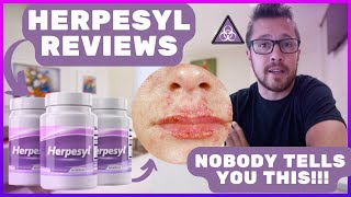 HERPESYL REVIEWS  Herpesyl Review  Does Herpesyl Really Work Herpesyl Honest Review [upl. by Eberta680]