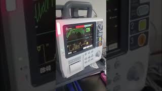 Reversão de taquicardia supraventricular com manobra de Valsalva modificada cardiologia [upl. by Annair]