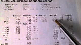 Espirometria Interpretacion Simple [upl. by Ainej494]